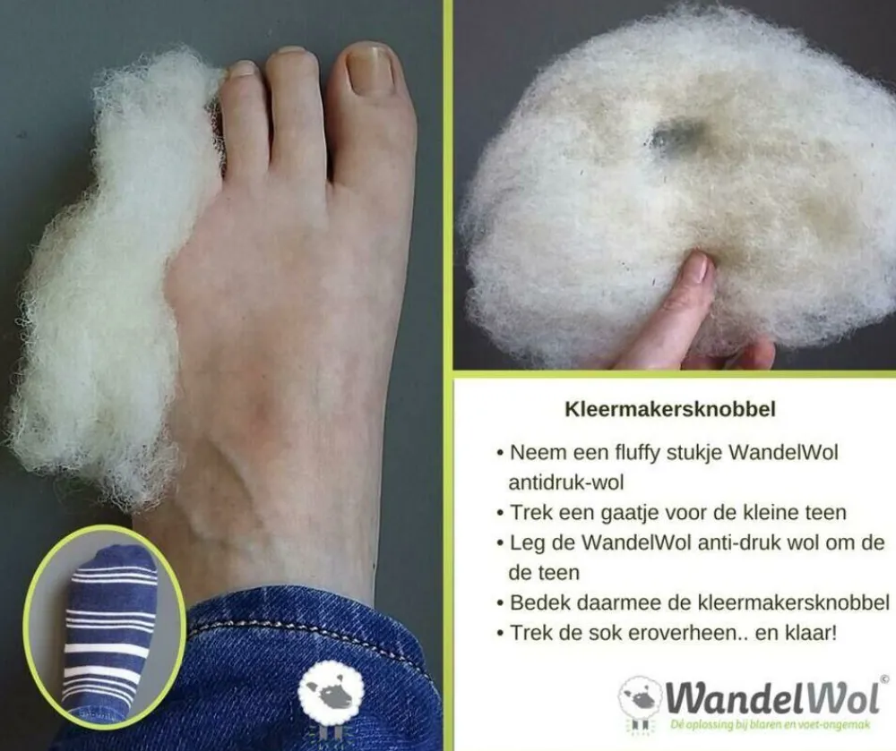wandelwol Voetverzorging|10 gram